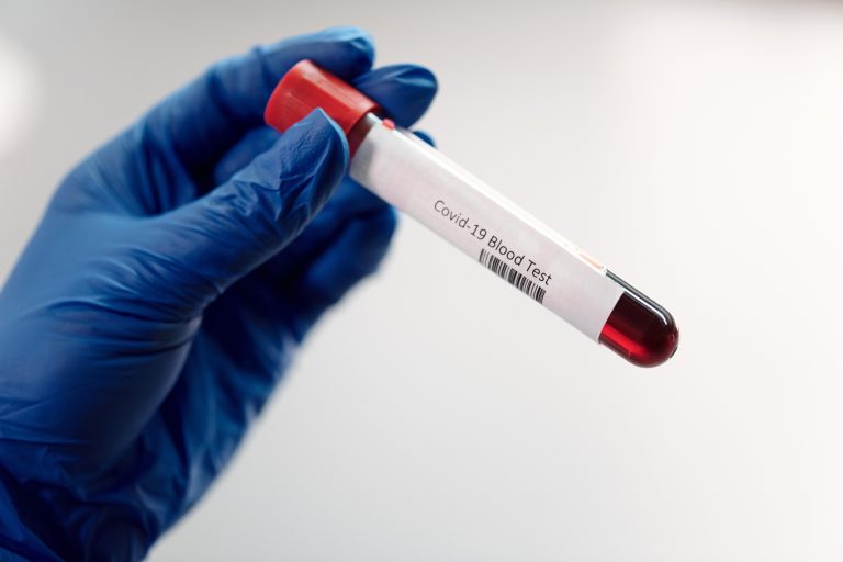 After I've Received my Vaccine, should I get a Blood Test to see if I have Antibodies for Covid-19?