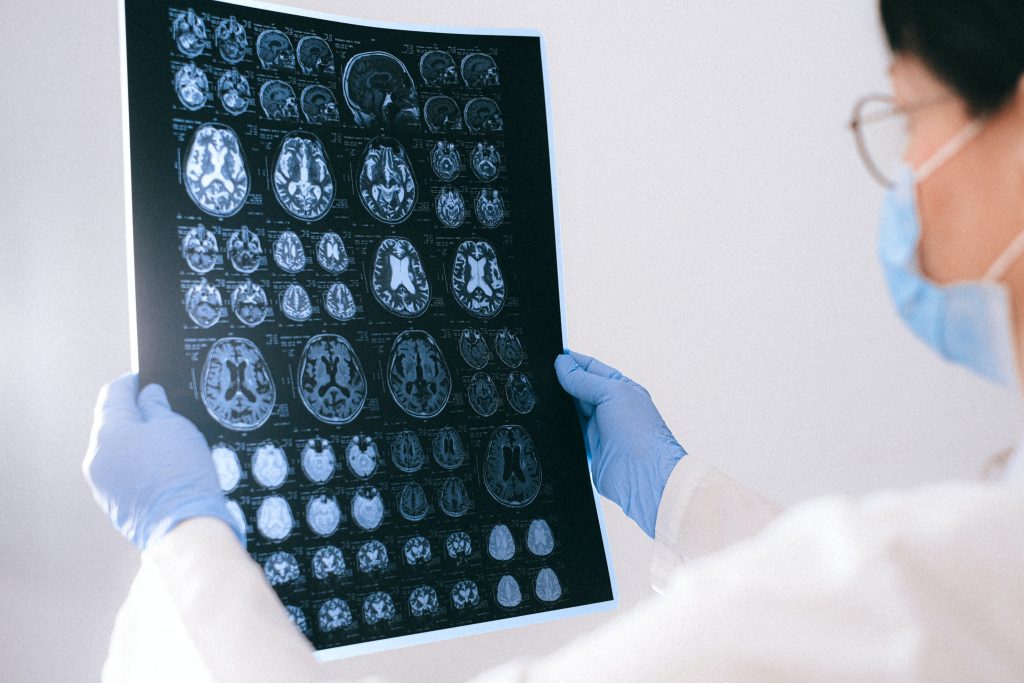 Brain Mammogram