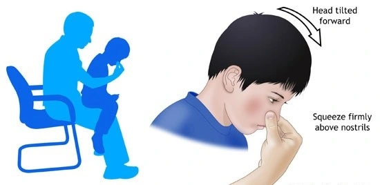 Simple Measures to Stop the Bleeding