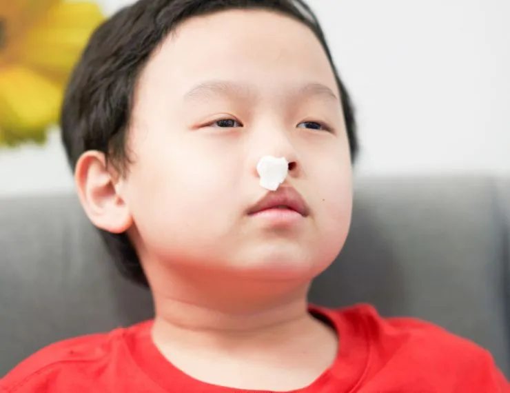 Nosebleed Treatment for Children